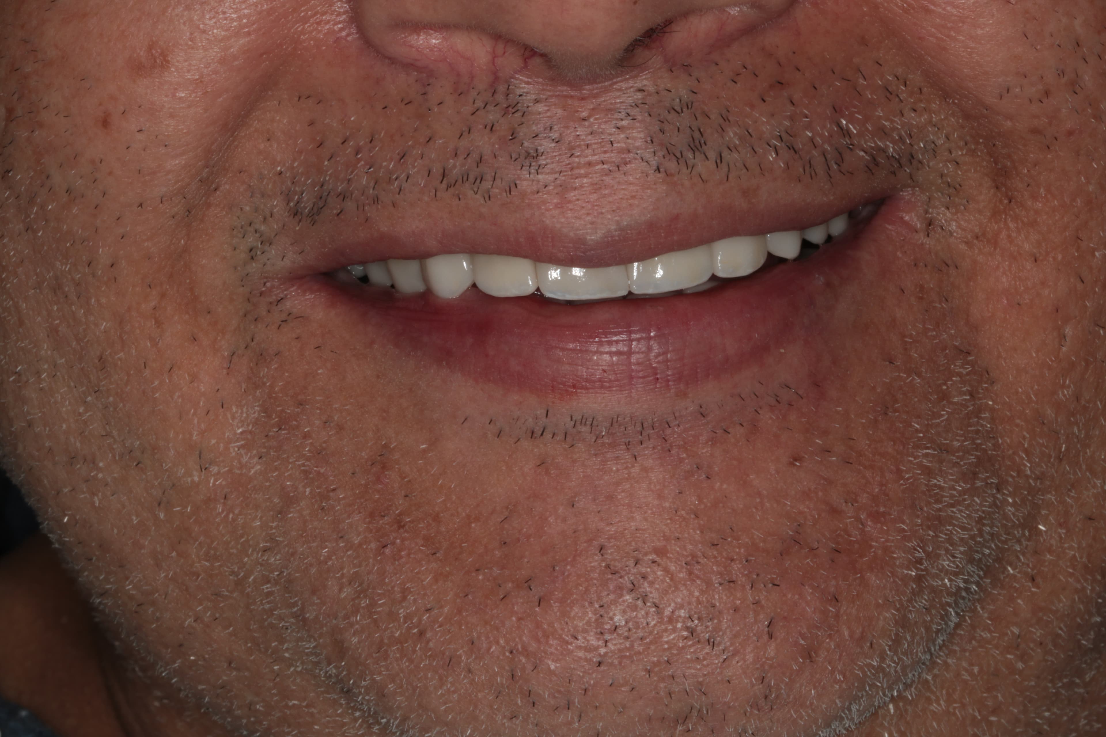 Caso 1 — foto 19