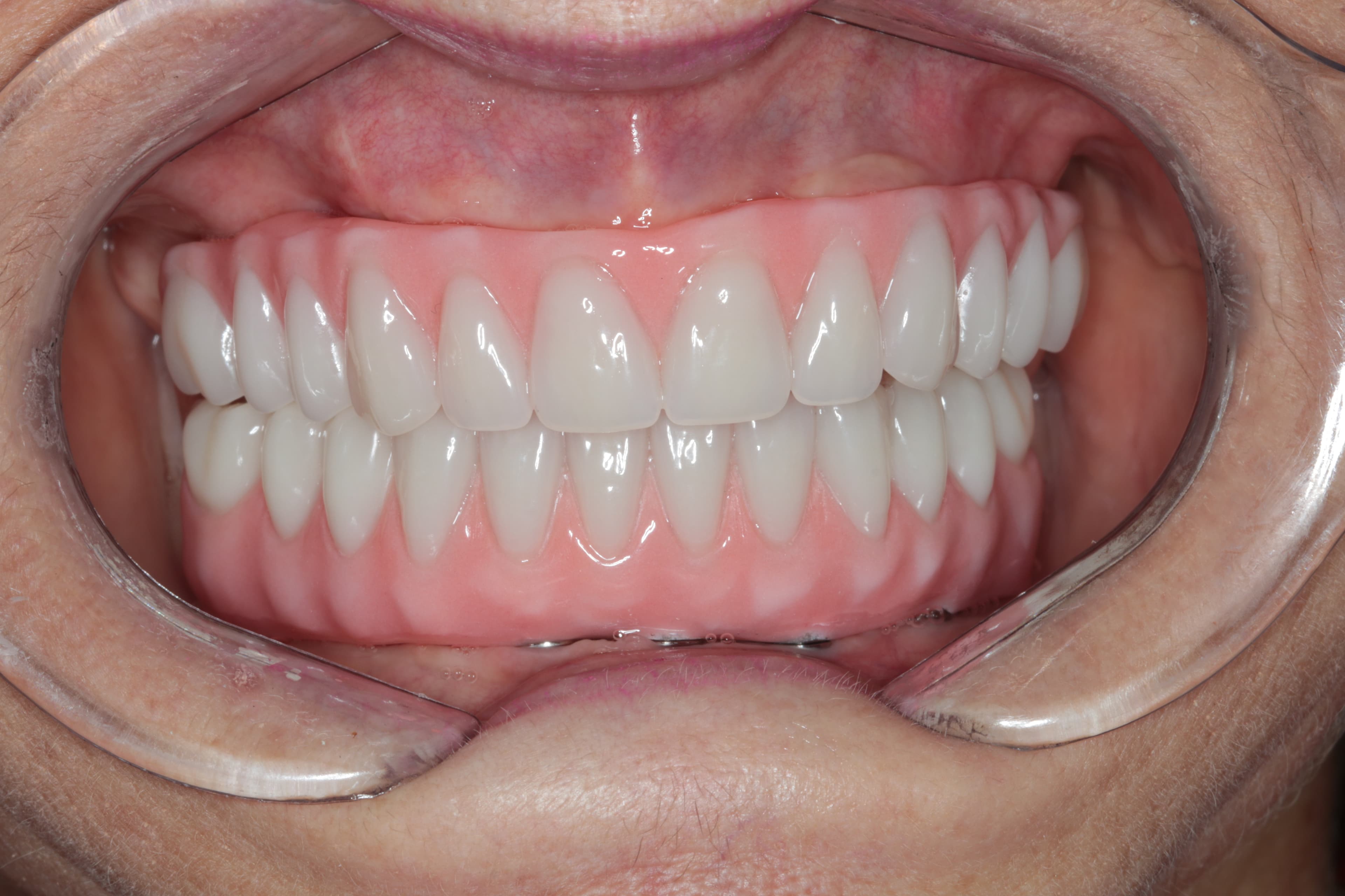 Caso 3 — foto 1