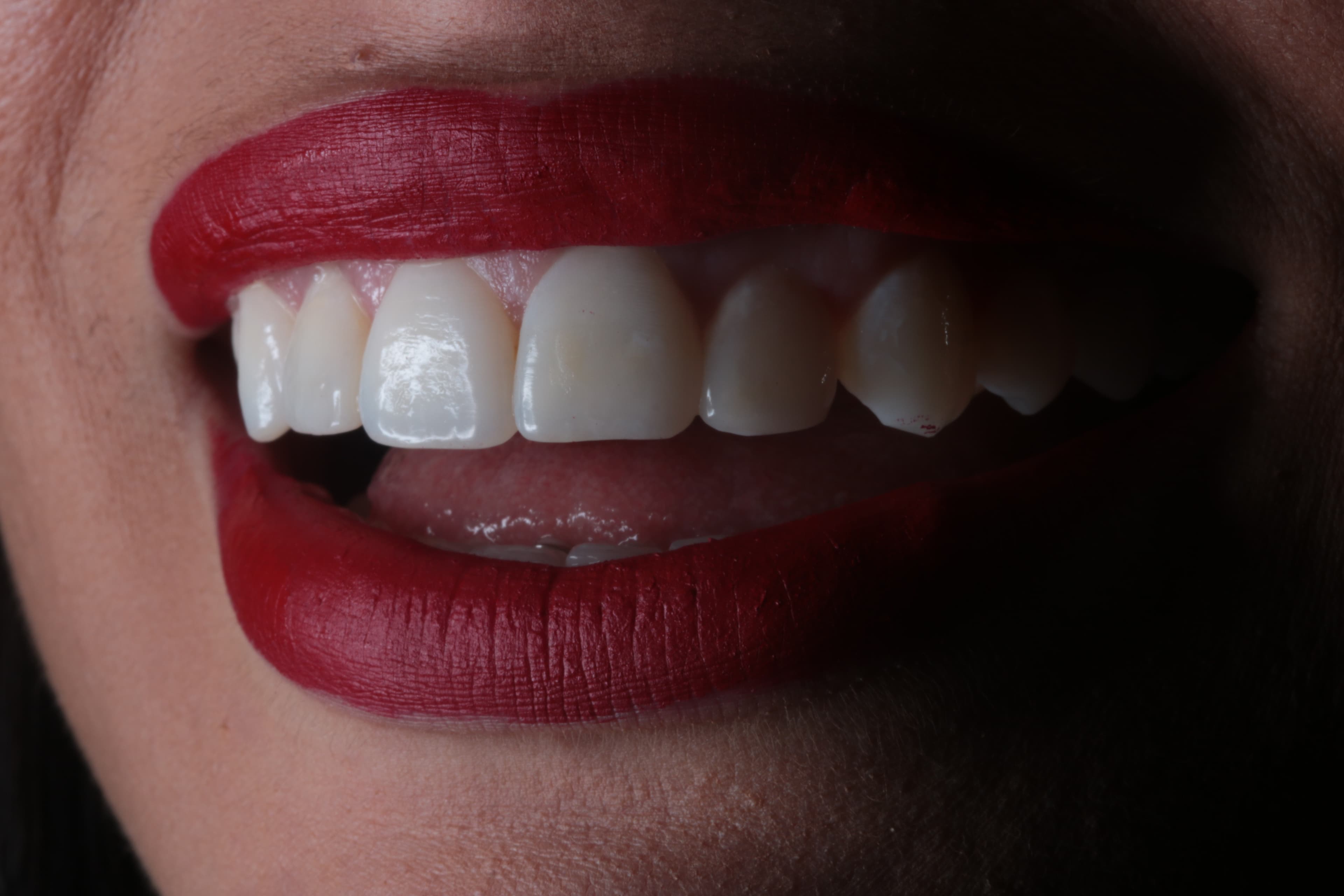 Caso 4 — foto 29