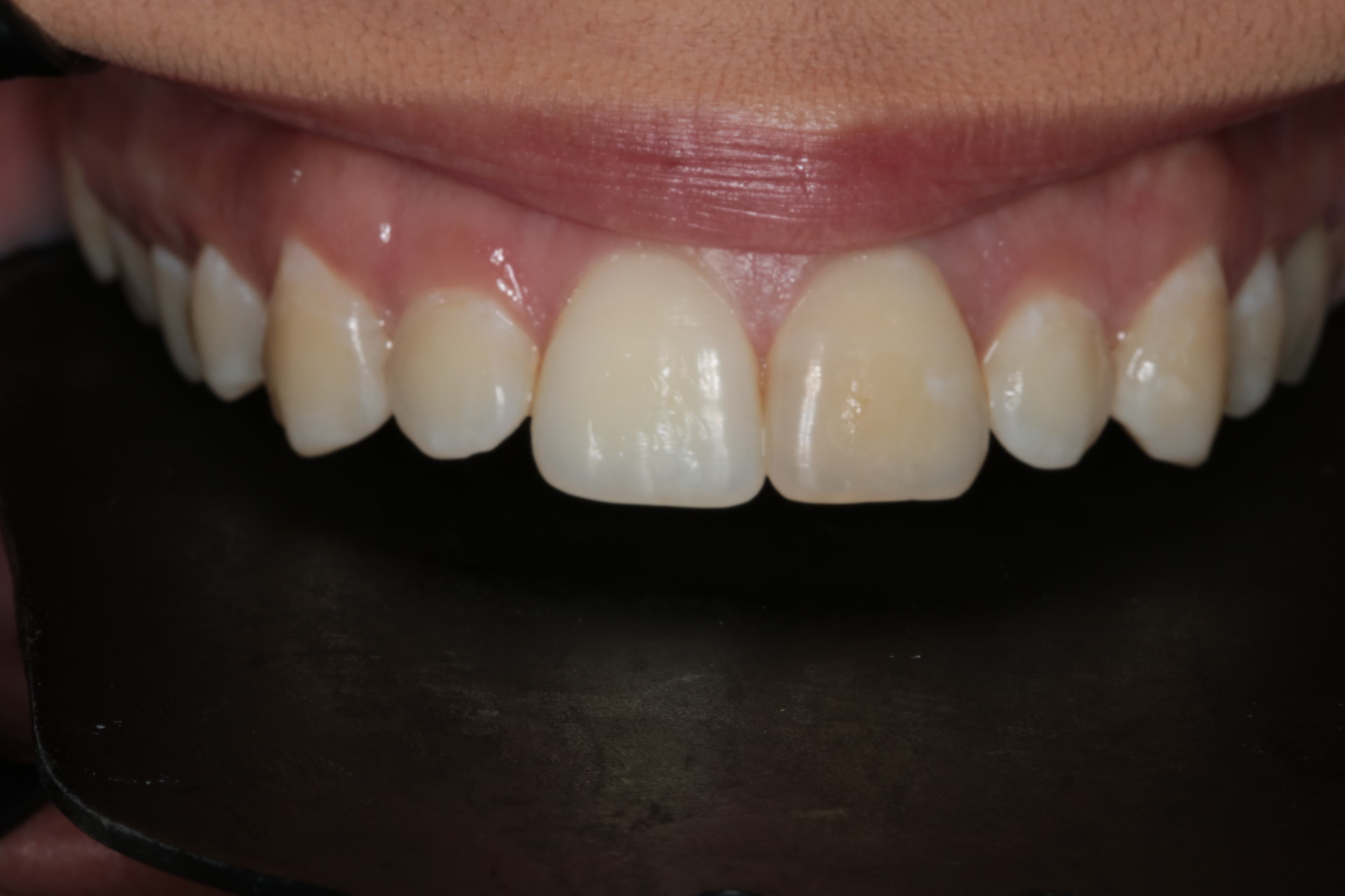 Caso 4 — foto 3
