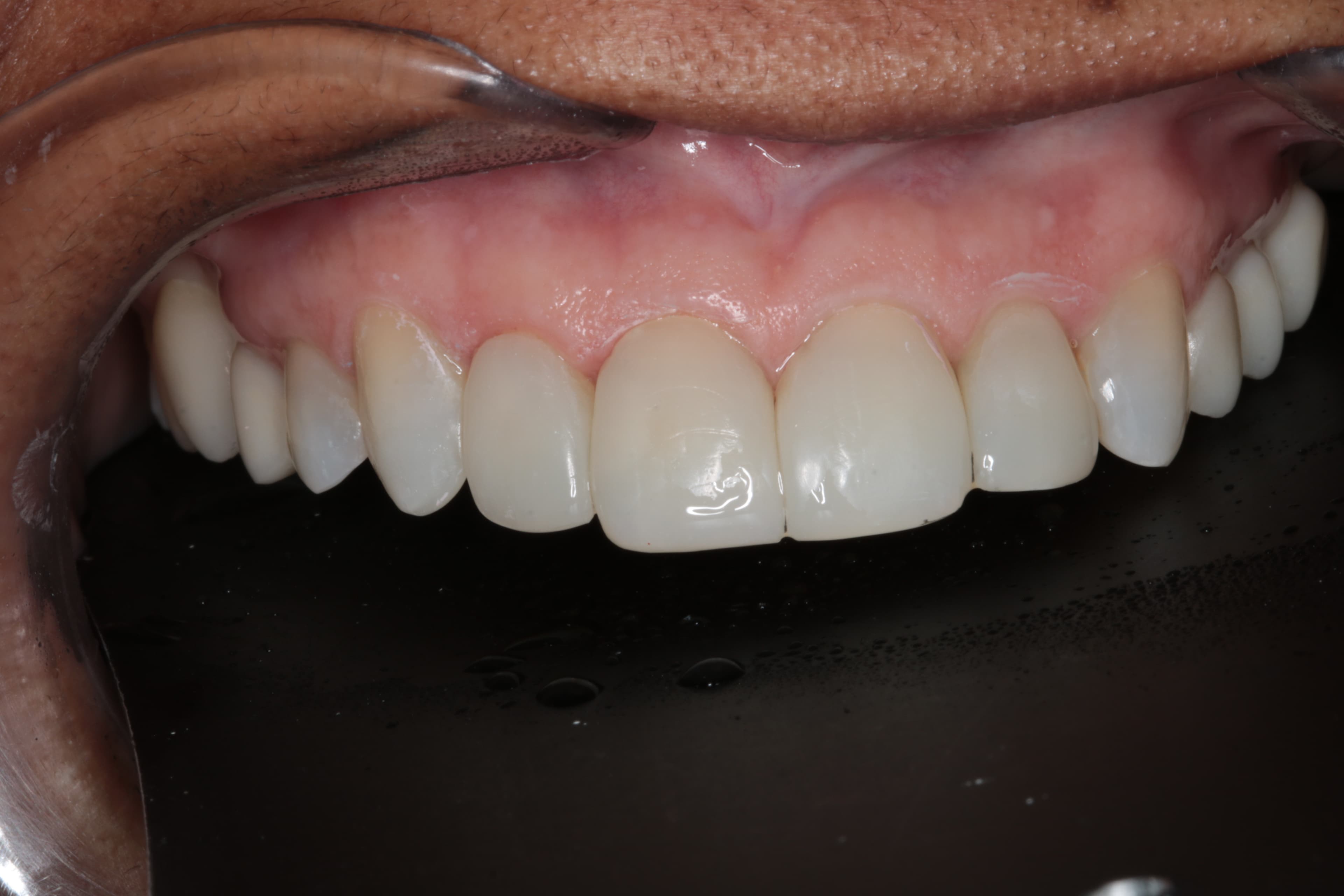 Caso 5 — foto 14