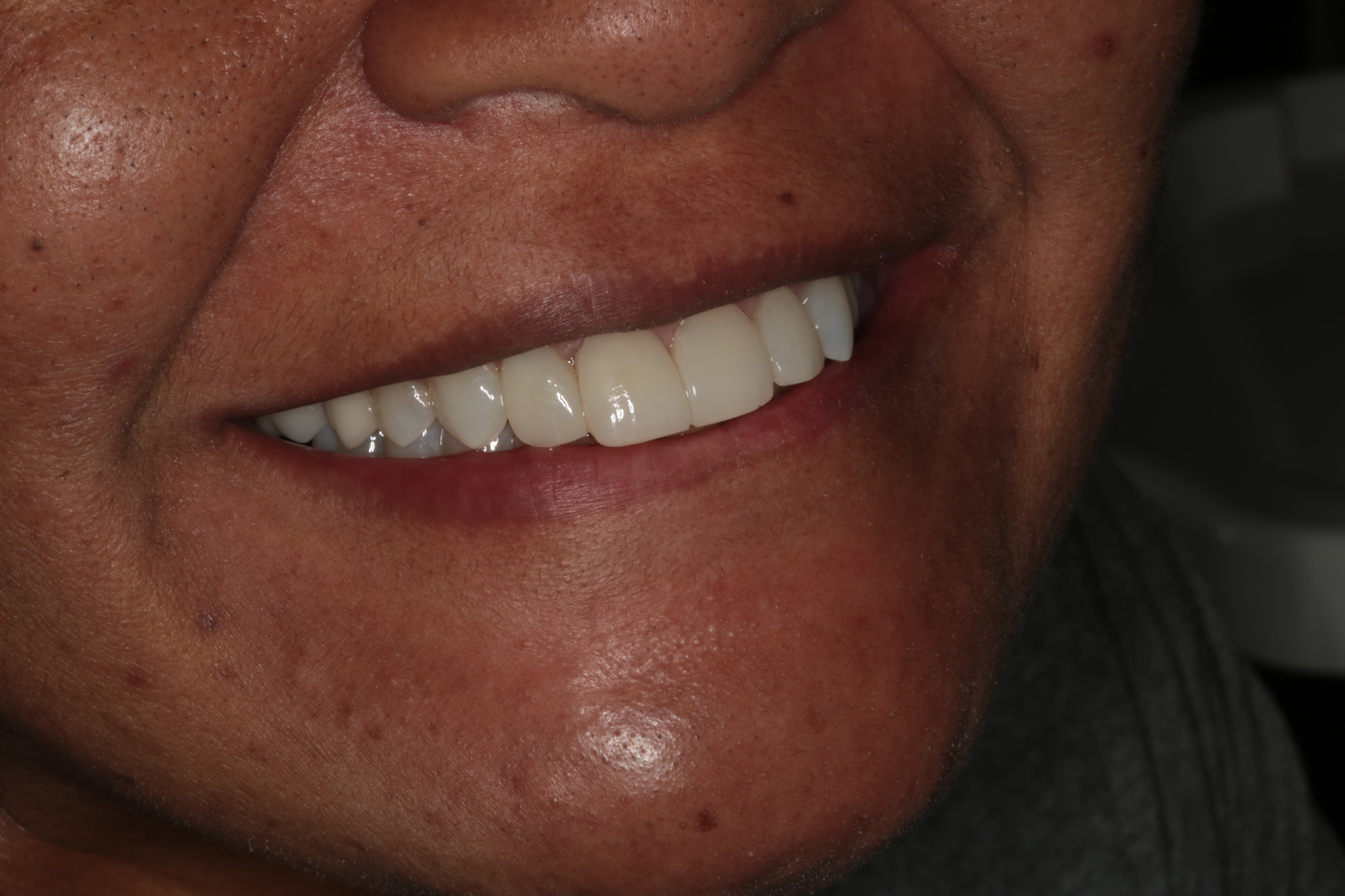 Caso 5 — foto 15