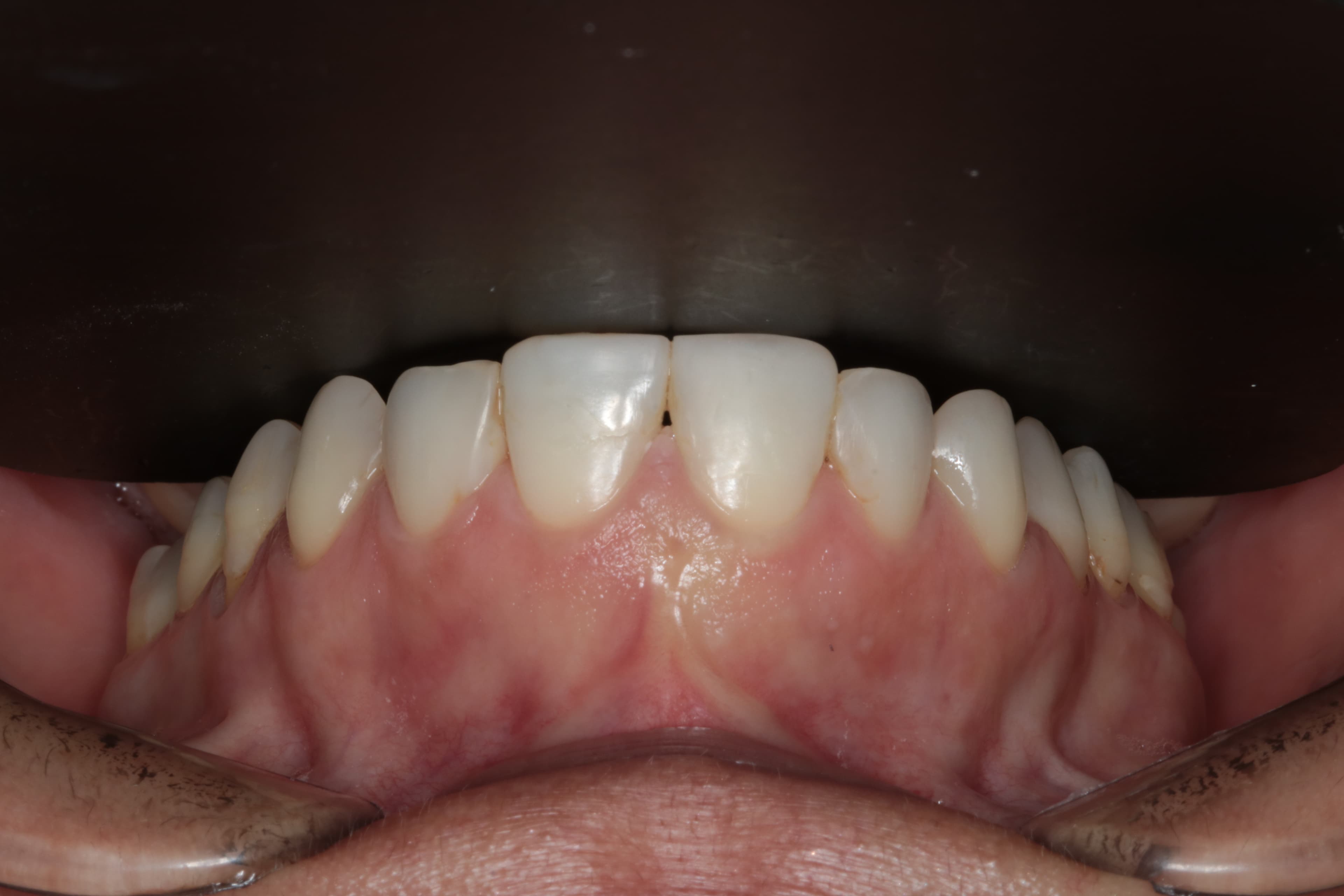 Caso 6 — foto 7